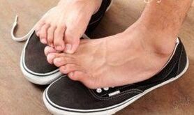 Itching as a cause of fungi