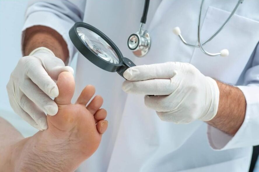 the doctor examines the nails for fungus