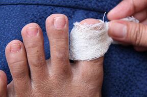 A sick nail