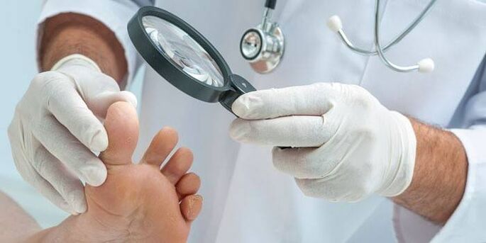 The doctor examines the feet for fungus between the toes.