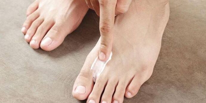 ointment for the treatment of fungus between the toes